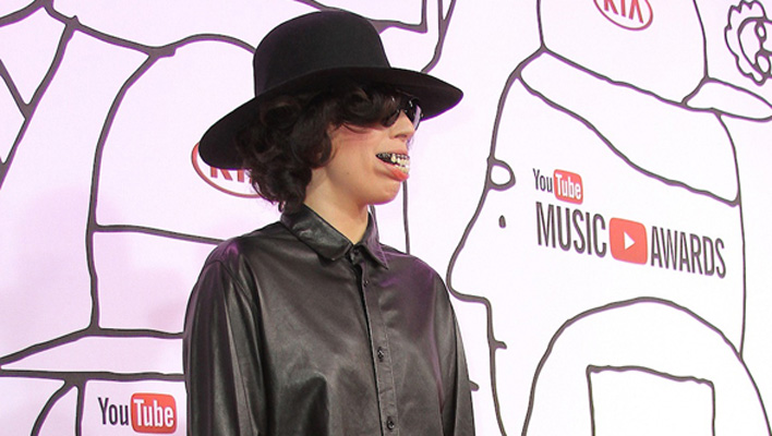 Lady Gaga falsche Zähne