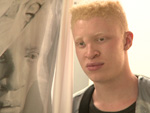 Promis feiern Shaun Ross: Das berühmteste Albino-Model der Welt in Berlin