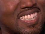 Kanye West: Leistet sich teure Zähne