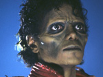 Michael Jackson: Leidet an einer Haut-Infektion?