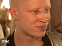 Das international renommierten Albino-Models Shaun Ross
